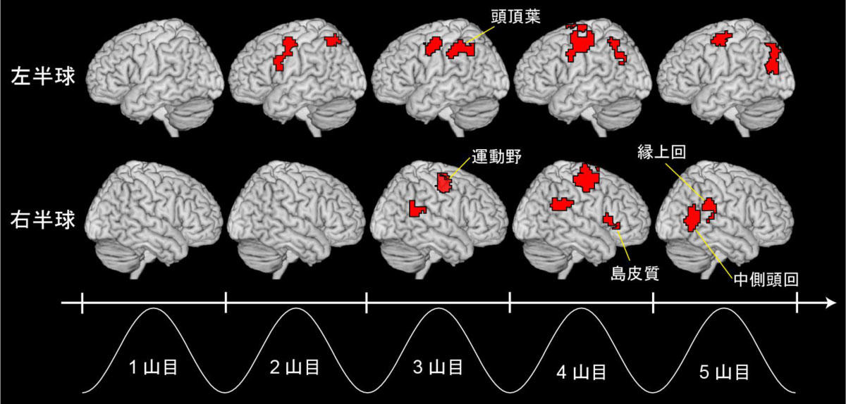 図２　どの程度自分の運動だと感じていたかを脳活動から予測できる領域