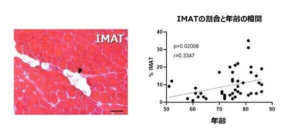 高齢者の骨格筋内の脂肪組織（IMAT）