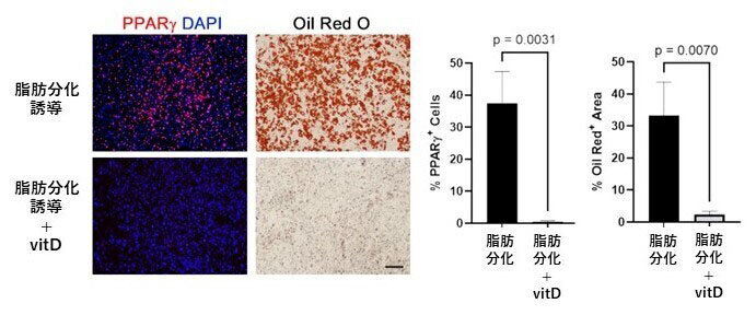 間葉系前駆細胞の脂肪細胞分化はビタミンDで阻害される