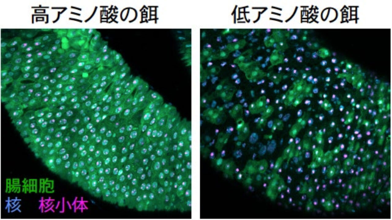 低アミノ酸の食餌で誘導された腸の細胞死(黒い部分)